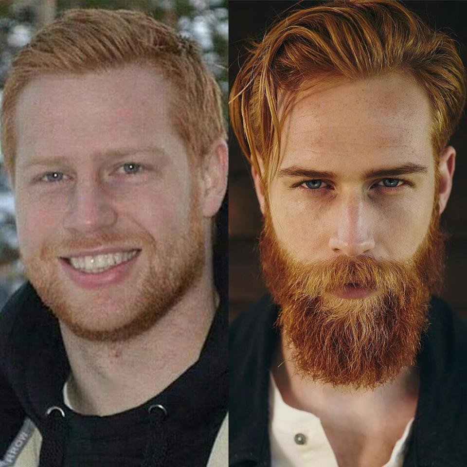 Люди с бородой и без бороды до и после фото